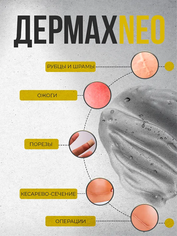 Дермах neo - Силиконовый гель от шрамов и рубцов