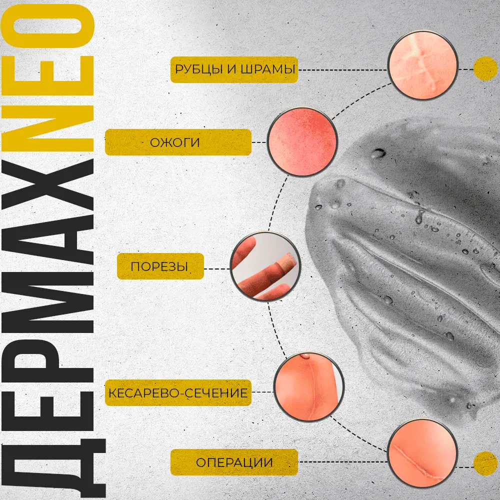 dermax-neo-3