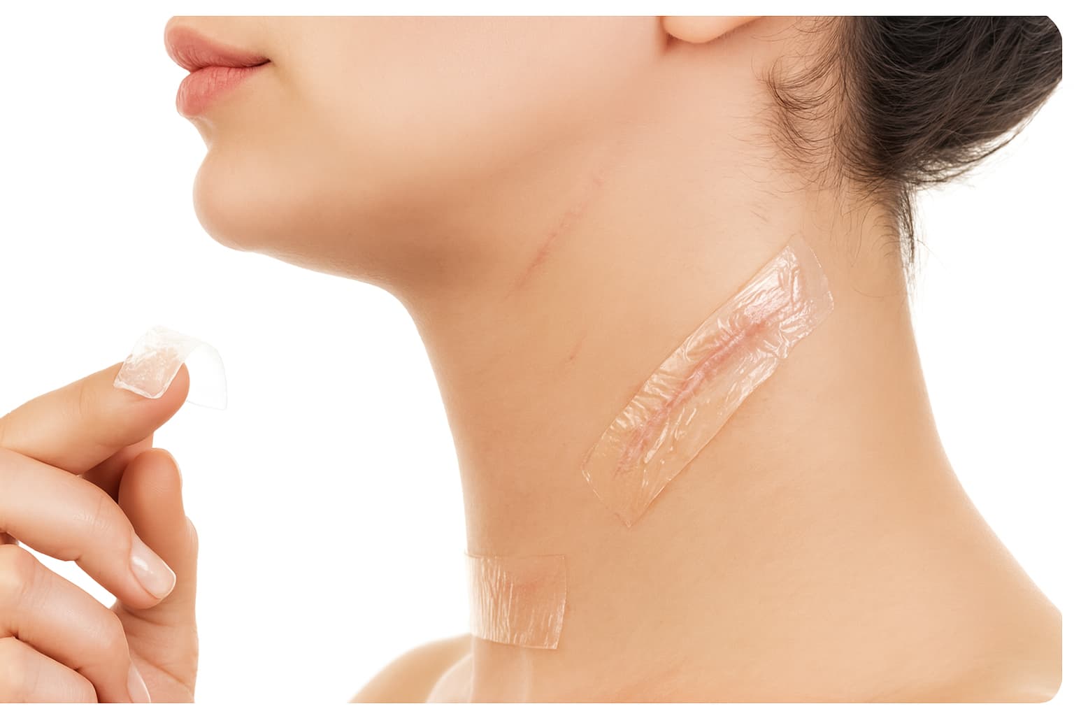 Как избавиться от шрамов — лучшие методы