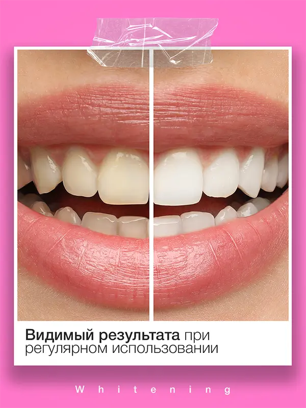WHITENING