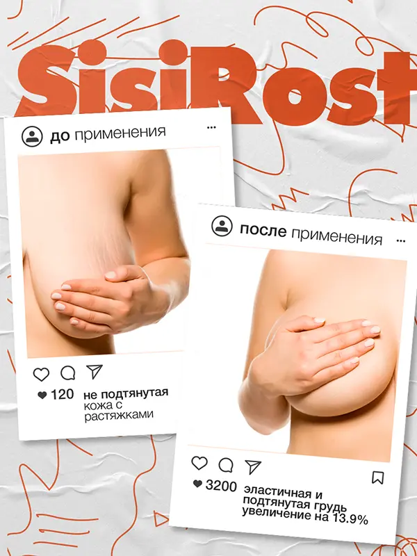 SISIROST