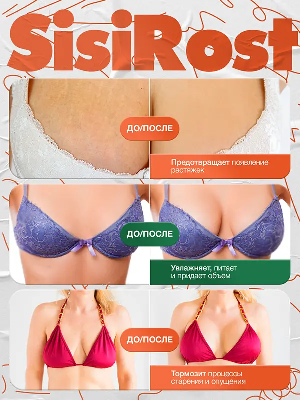 SISIROST