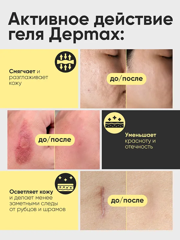 Дермах neo