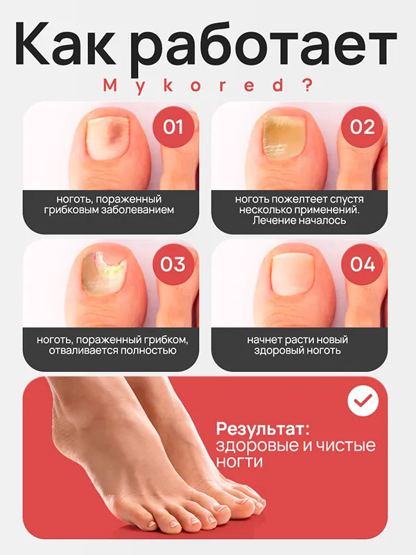 Mykored