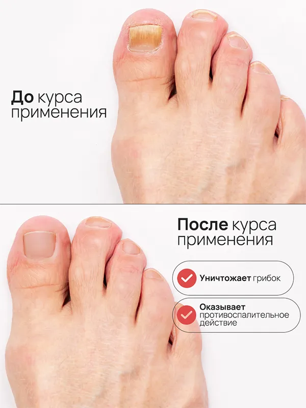 Mykored
